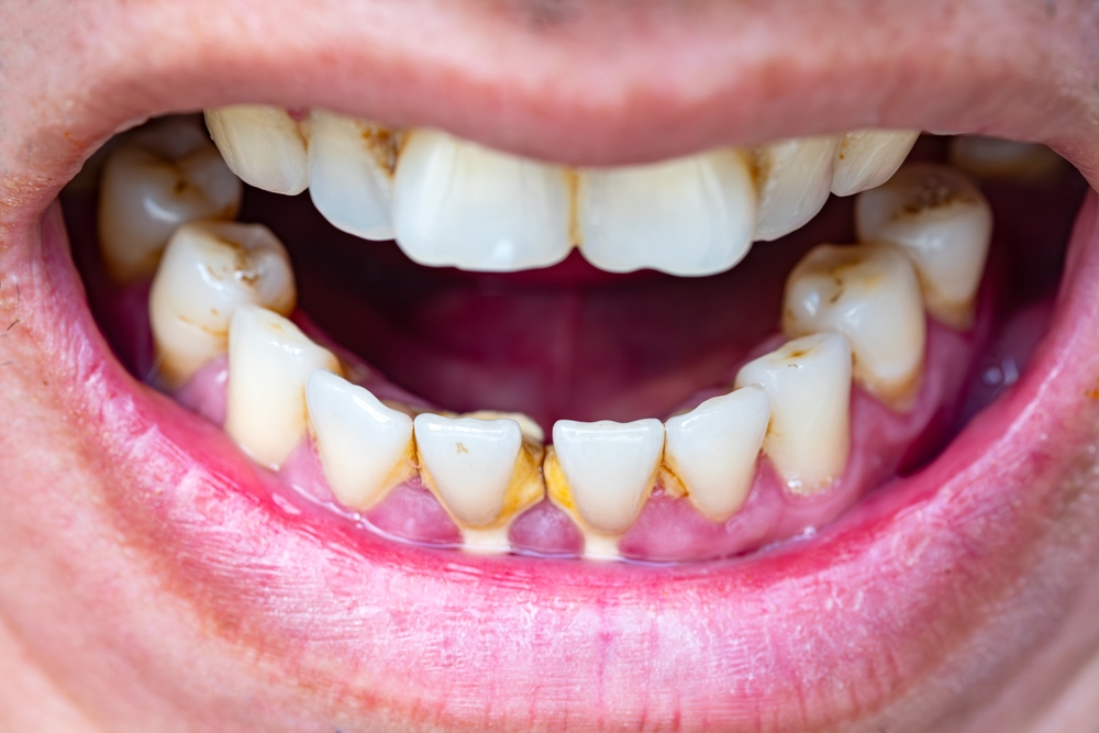 Are Nicotine Lozenges Bad For You